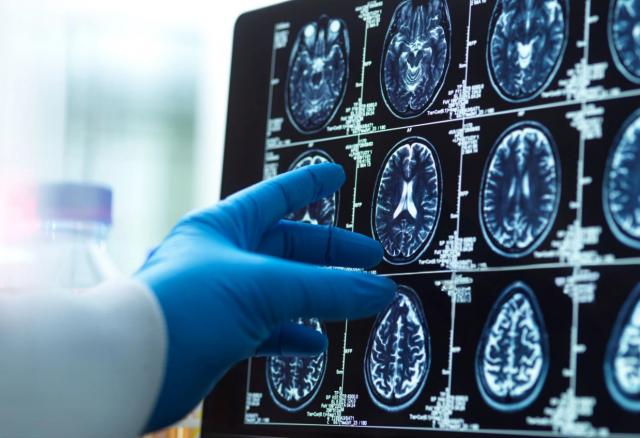 8 yıllık araştırma sonuçlandı. İşte demans riskini yüzde 40 azaltan aktivite