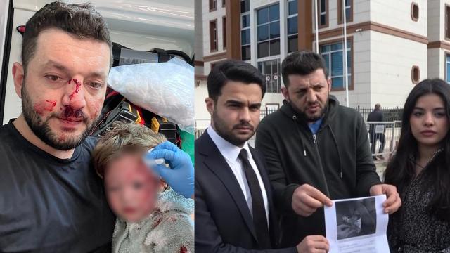 Yalova'da baba ile 14 aylık kızının darbedilmesi. Bebeğe vurduğunu kabul etti!  