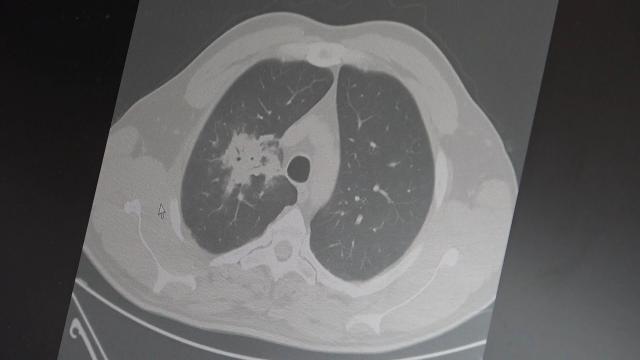 Elektronik sigara için 