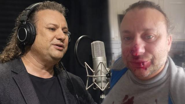  Ünlü sanatçı et yiyen bakteriyle savaşıyor